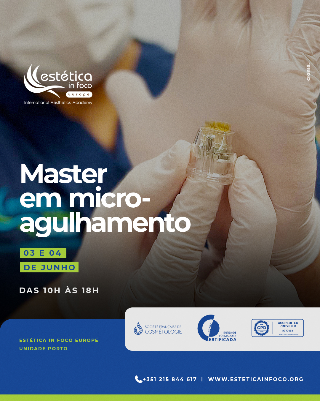 03 e 04 de Junho – Porto – Master em Microagulhamento